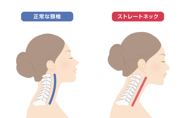 首への負担